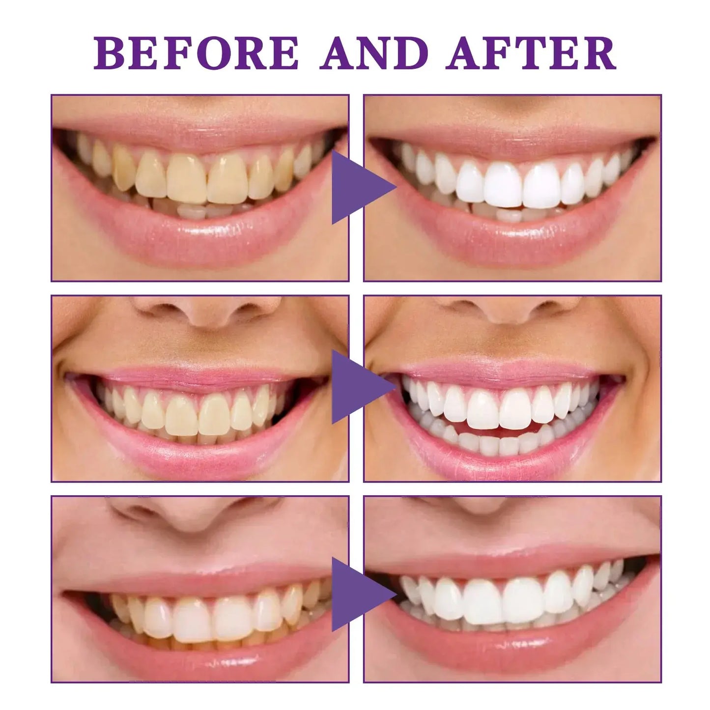 V34 Tooth Cleaning Mousse Top100