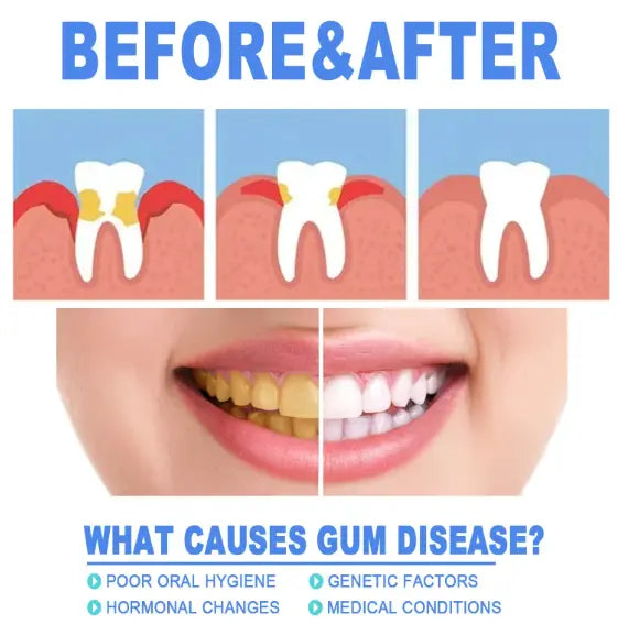 Teeth Repair Gel Top100