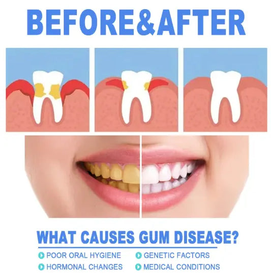Teeth Repair Gel Top100