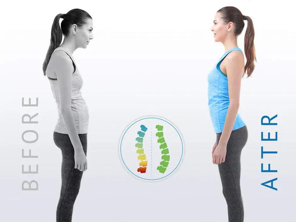 Posture Corrector Top100