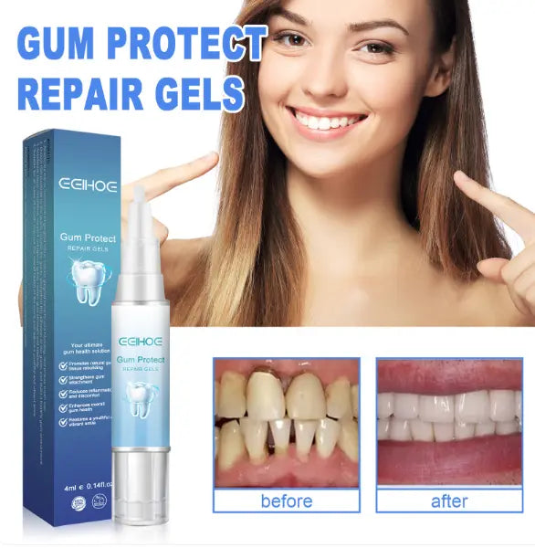 Teeth Repair Gel Top100
